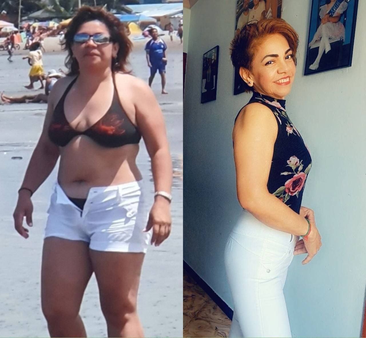 Teresa — antes y después de su transformación